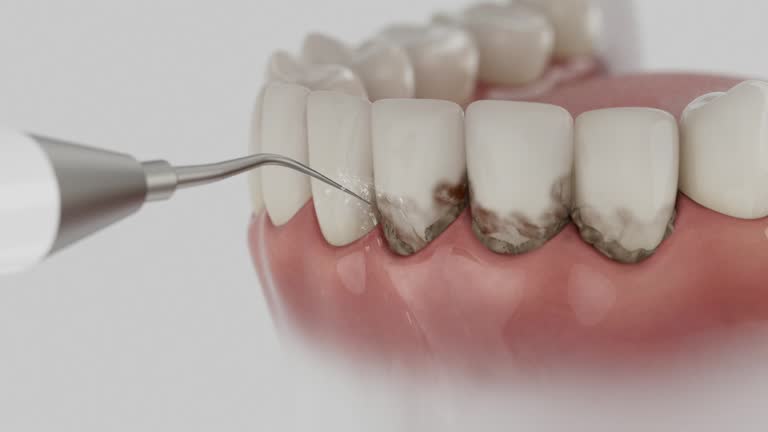 Trusted Tooth Extraction service in Grosse Pointe Farms, MI - Dentist Open Now